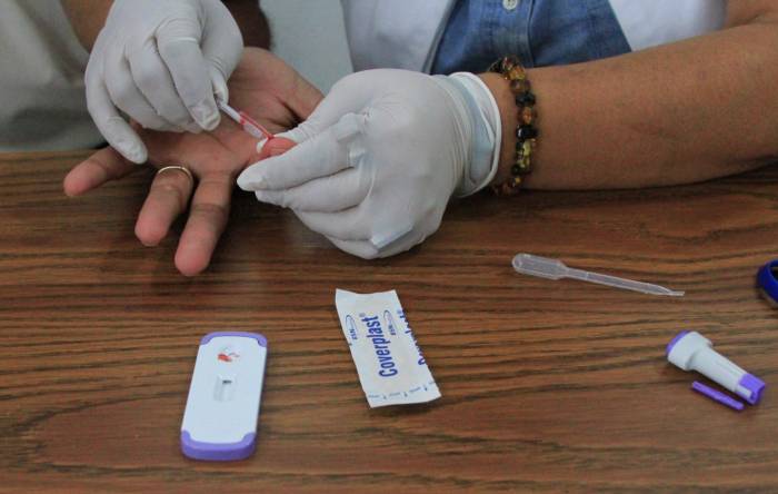 pruebas para detectar VIH