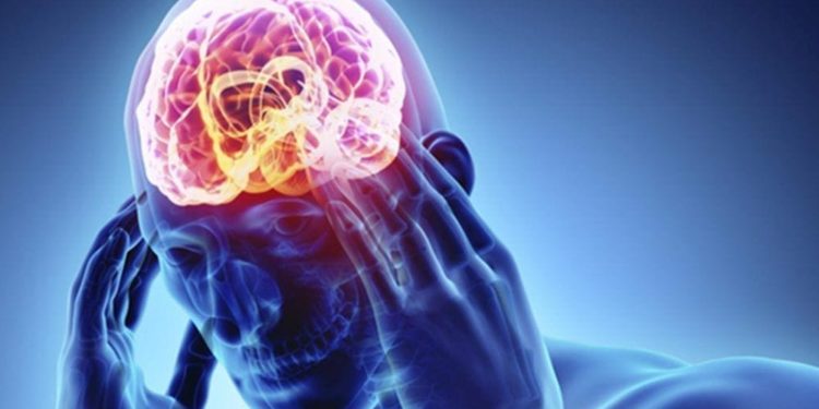 epilepsia